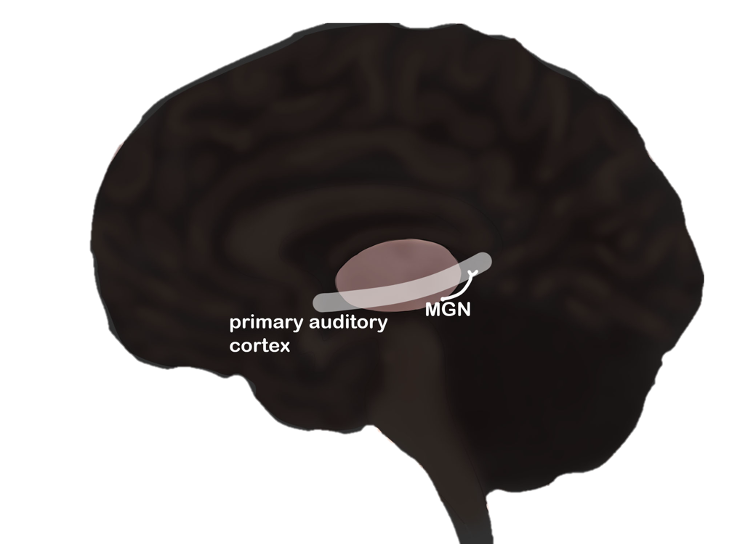 Projection of the MGN to the primary auditory cortex