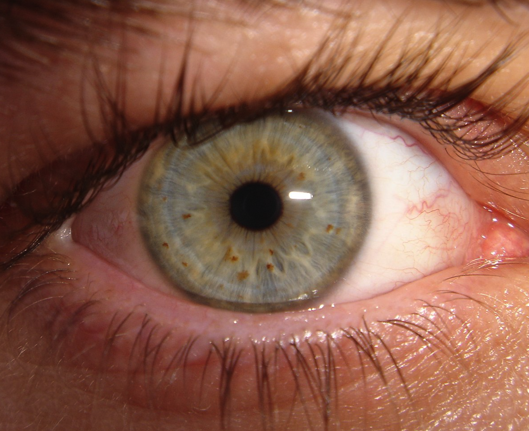 image.eye