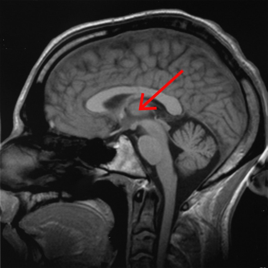 image.thalamus