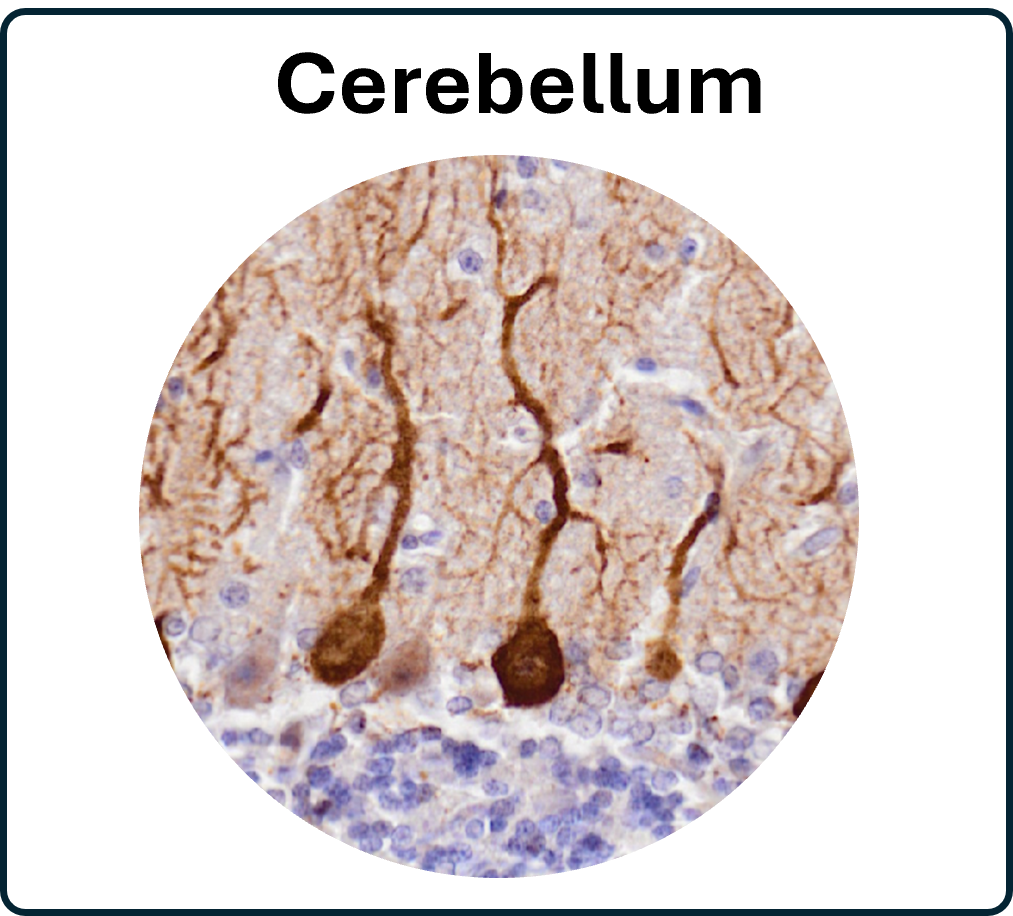 go to the cerebellum