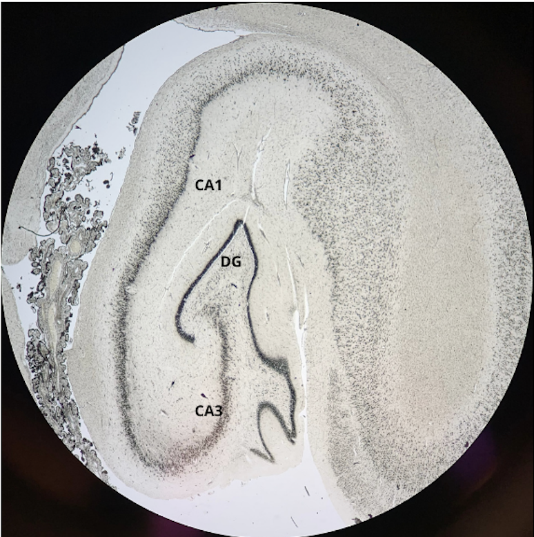 picture of hippocampal structures